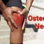 osteoartrit-nedir?