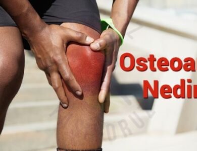 osteoartrit-nedir?
