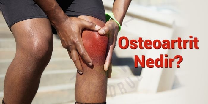 osteoartrit nedir